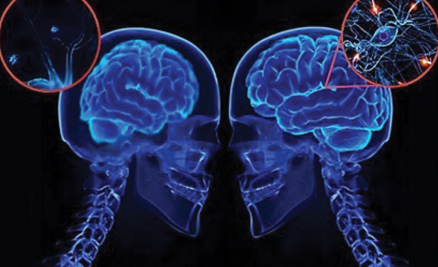Brain 84. Проявления деятельности мозга человека.. Увеличение мозга. Увеличение мозга спор. Фоновая активность головного мозга Мэг.